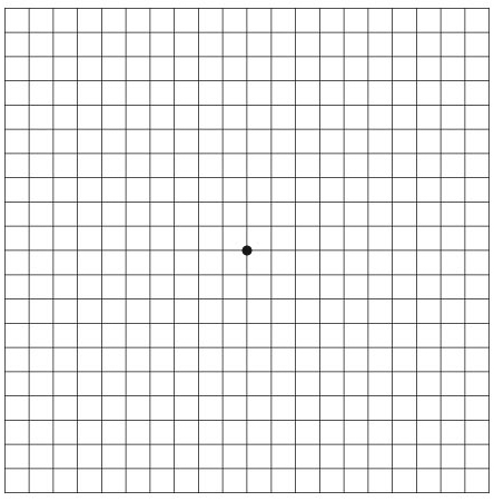 test visivi